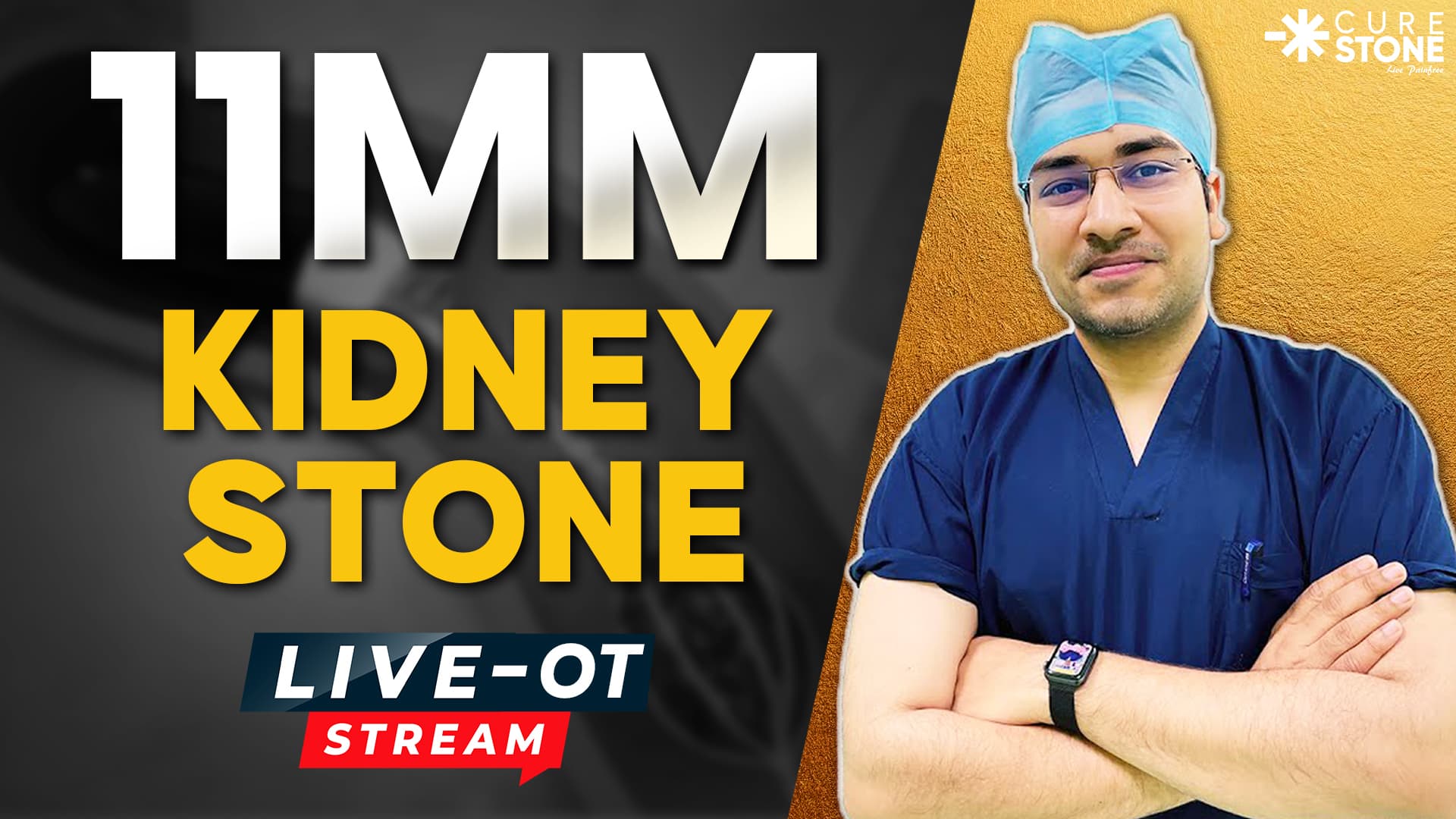 11mm Kidney Stone Removal