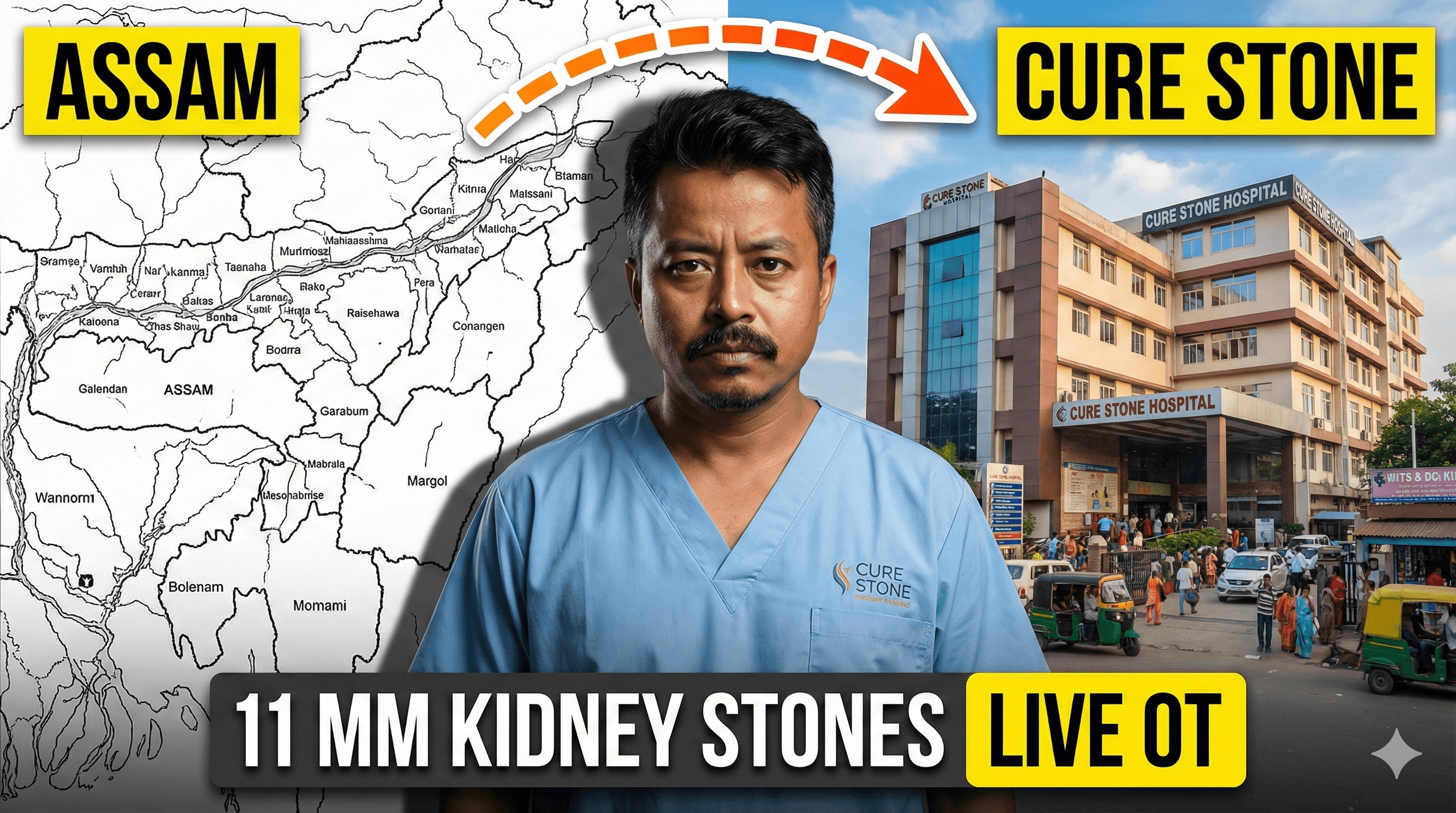 Assam To Cure Stone